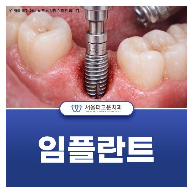 임플란트는 제대로 하는 것이 중요합니다. 믿을 수 있는 치과